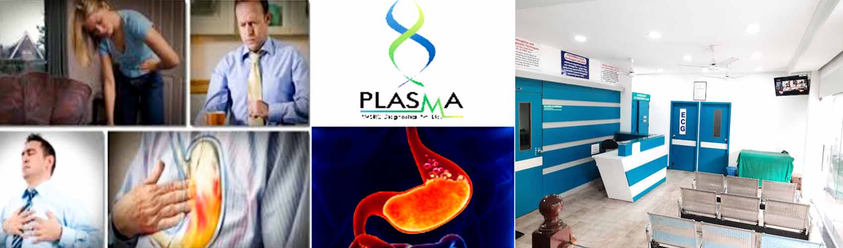 Plasma Diagnostics