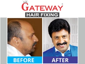 Are you searching for best Hair Fixing , Beauty Spa and Saloon, Beauty Products  , in Palakkad Kerala ?. Click here to get Gateway Hair Fixing  contact address and phone numbers